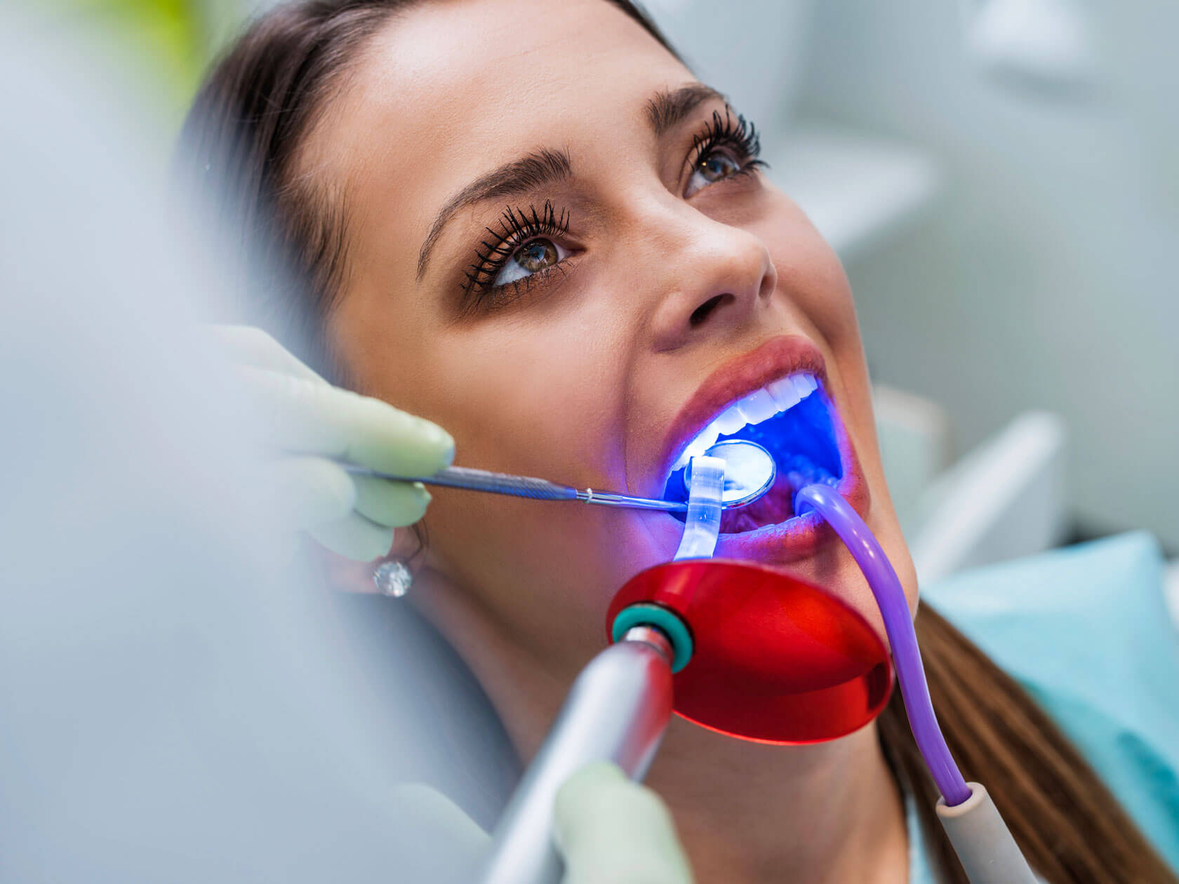 Dentisterie au laser centre dentaire Côte Vertu